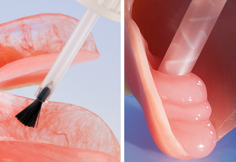 Silagum-Comfort. DMG - Hochwertige Dentalmaterialien für Zahnärzte und  Zahntechniker