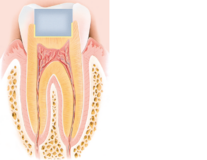 Figura: seção transversal de um dente